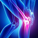 Peripheral Nerve Blocks and the Post-op Total Knee Replacement Patient
